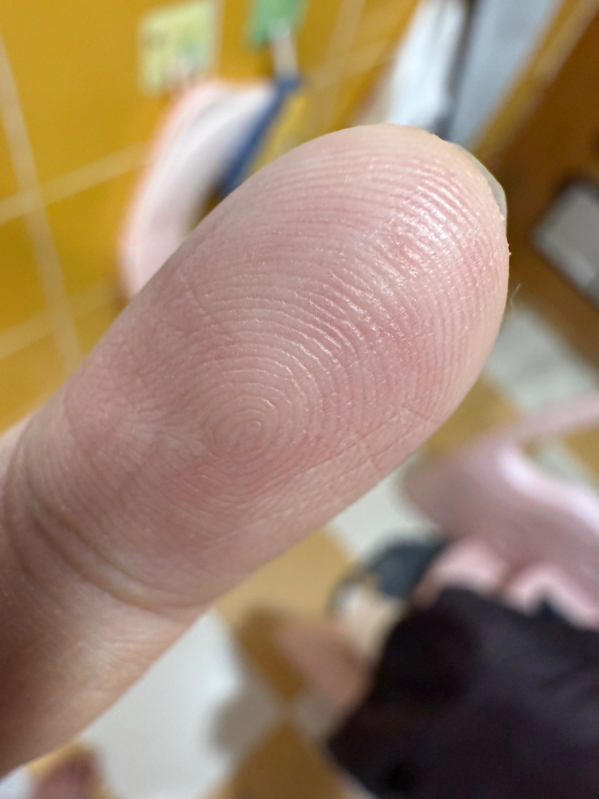 左手尾指