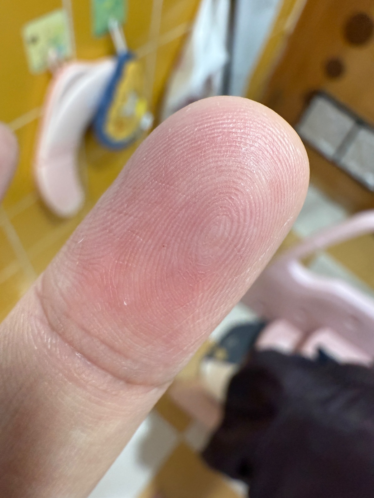 左手中指