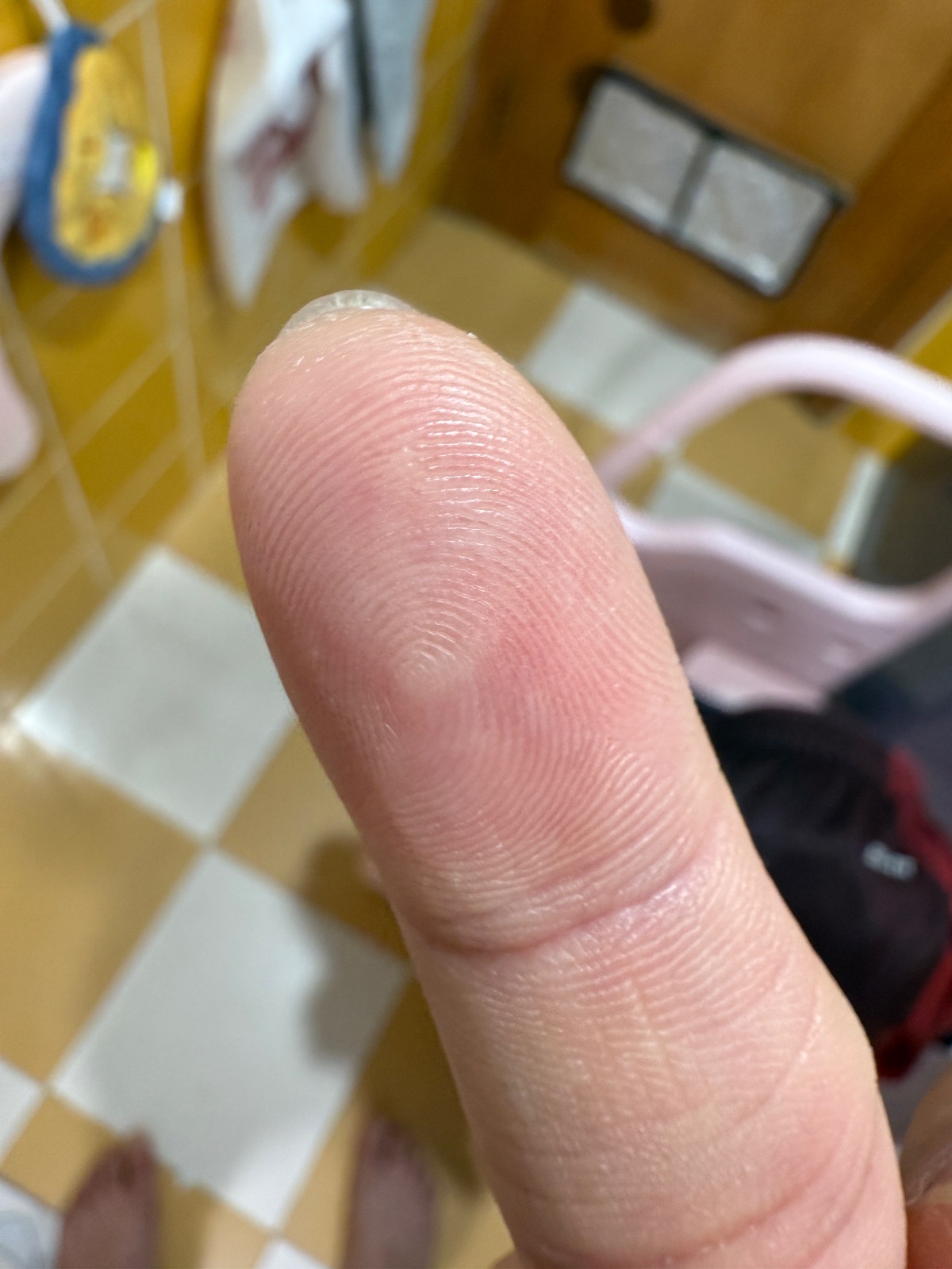 右手食指
