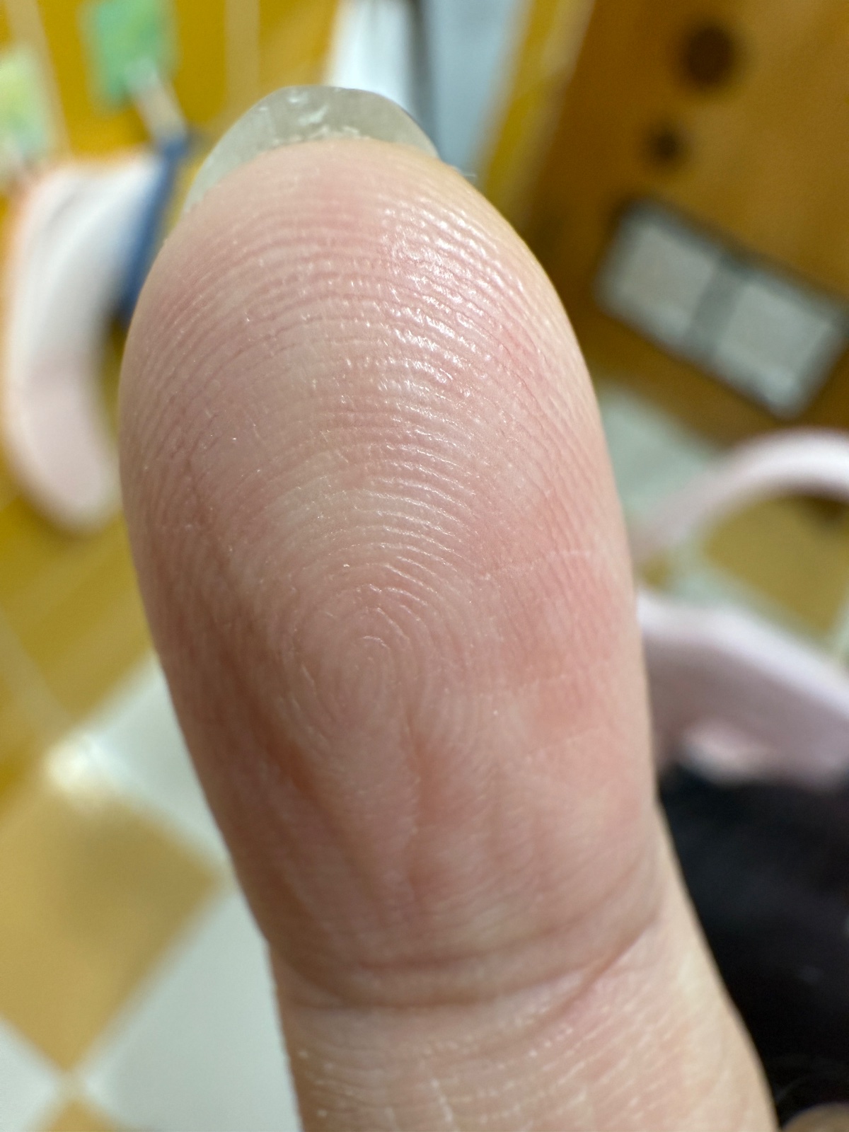 右手尾指