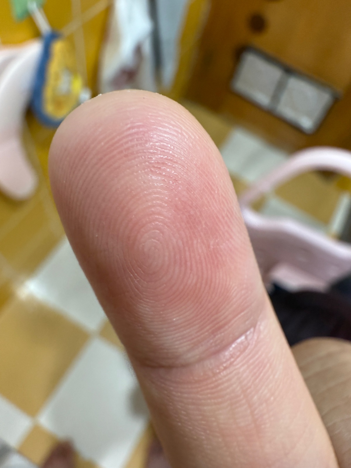 右手中指
