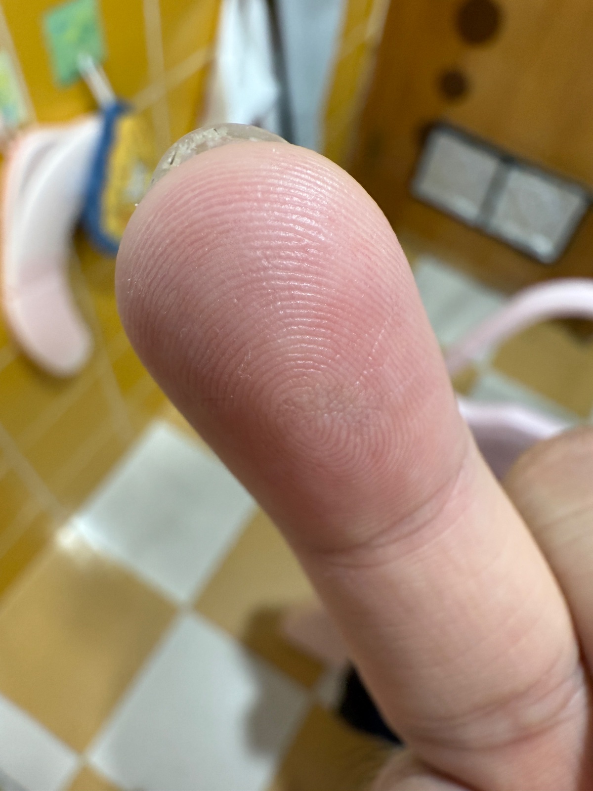 右手無名指